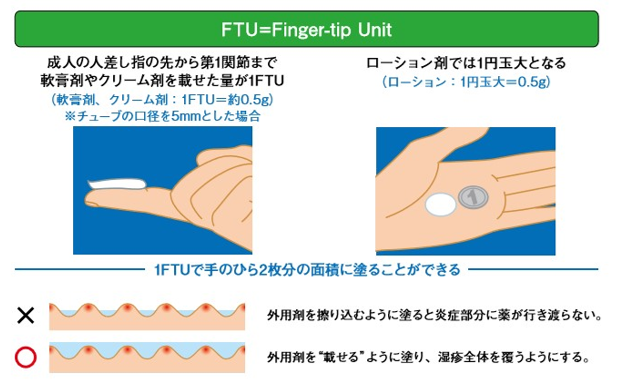 アトピー性皮膚炎の治療
